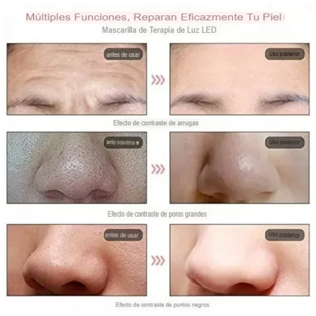 Máscara 7 Colores LED Facial-Cuello - Imagen 2